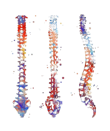 Χειρουργική Σπονδυλικής Στήλης